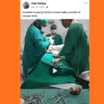 twin baby cesear alok